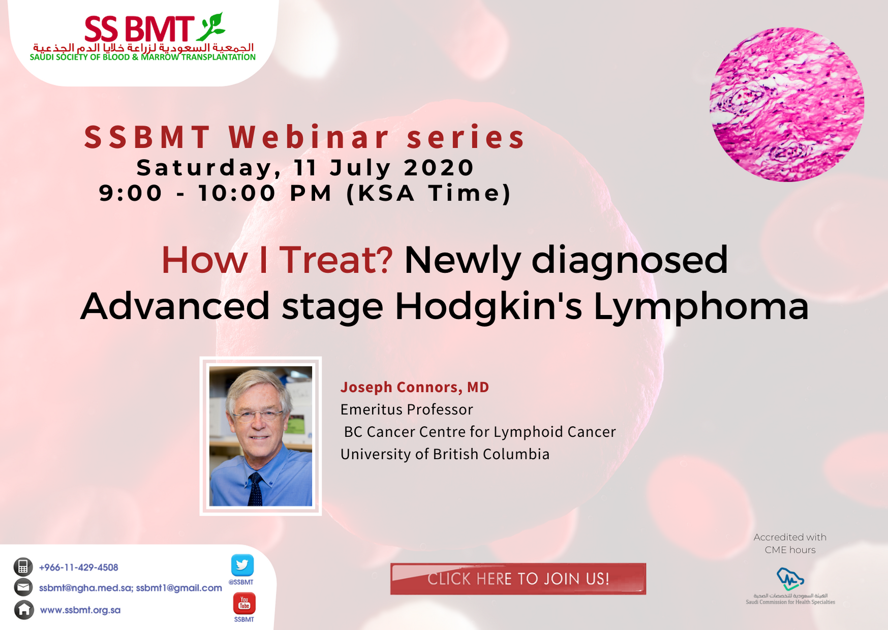 Newly diagnosed Advanced stage Hodgkin’s Lymphoma